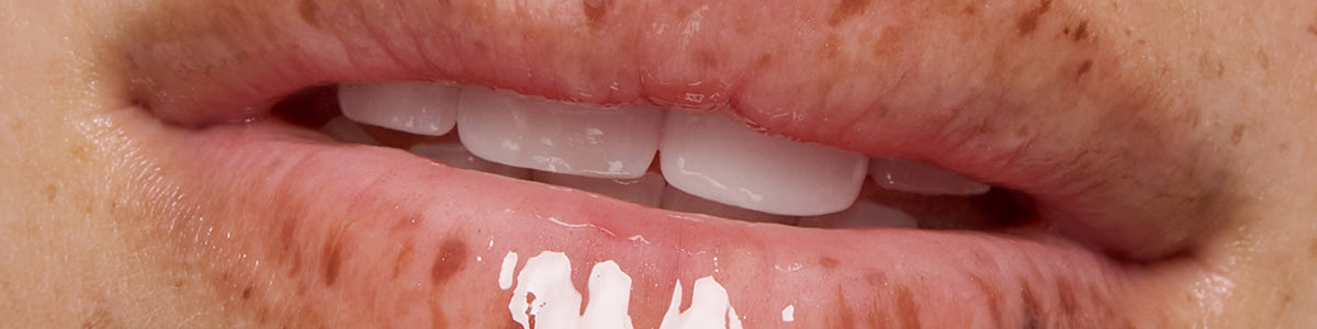 Nahaufnahme der Lippen mit glänzendem Lippenbalsam und sichtbaren Sommersprossen auf der umgebenden Haut.