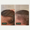 Vorher-Nachher-Vergleich des Haarwuchses einer Person vor und nach der Anwendung von Bio Plixin Serum+ Men von Scandinavian Biolabs; nachher etwas dichteres Haar.