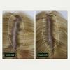 Vorher-Nachher-Bilder der Kopfhaut einer Frau zeigen weniger sichtbare Haarausdünnung nach der Anwendung von Bio-Pilixin® Serum+ Women von Scandinavian Biolabs.