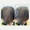 Vorher-Nachher-Vergleich des Haarwuchses einer Person vor und nach der Anwendung von Bio Plixin Serum+ Men von Scandinavian Biolabs; nachher etwas dichteres Haar.