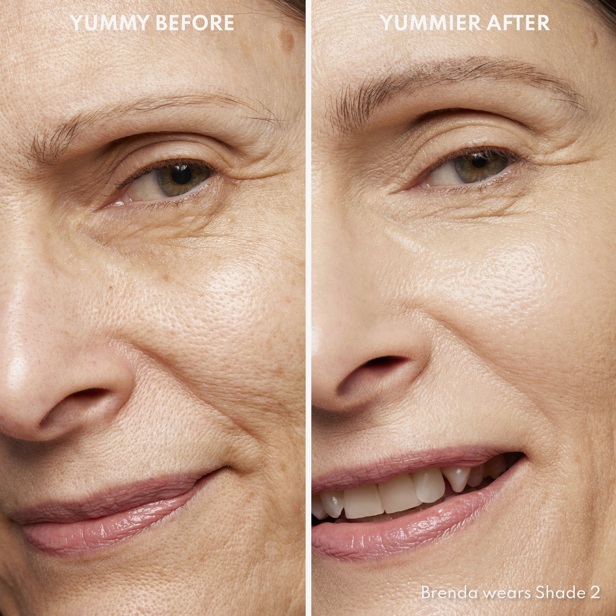 Vorher-Nachher-Bild einer Frau mit hellem Hautton nach Anwendung des Yummy Skin Serum Tint 2 – sichtbar ebenmäßiger Teint.