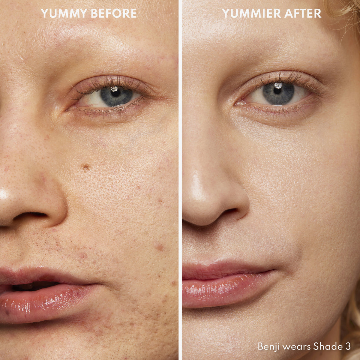 Vorher-Nachher-Bild einer Frau mit hellem Hautton nach Anwendung des Yummy Skin Serum Tint 3 – sichtbar ebenmäßiger Teint.