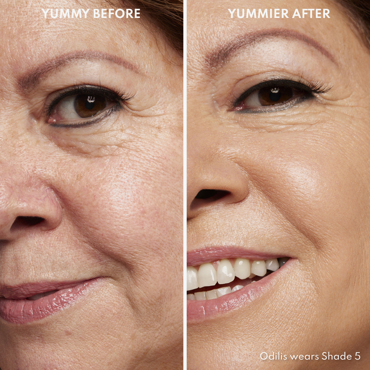 Vorher-Nachher-Bild einer Frau mit hellem bis mittlerem Hautton nach Anwendung des Yummy Skin Serum Tint 5 – sichtbar ebenmäßiger Teint.