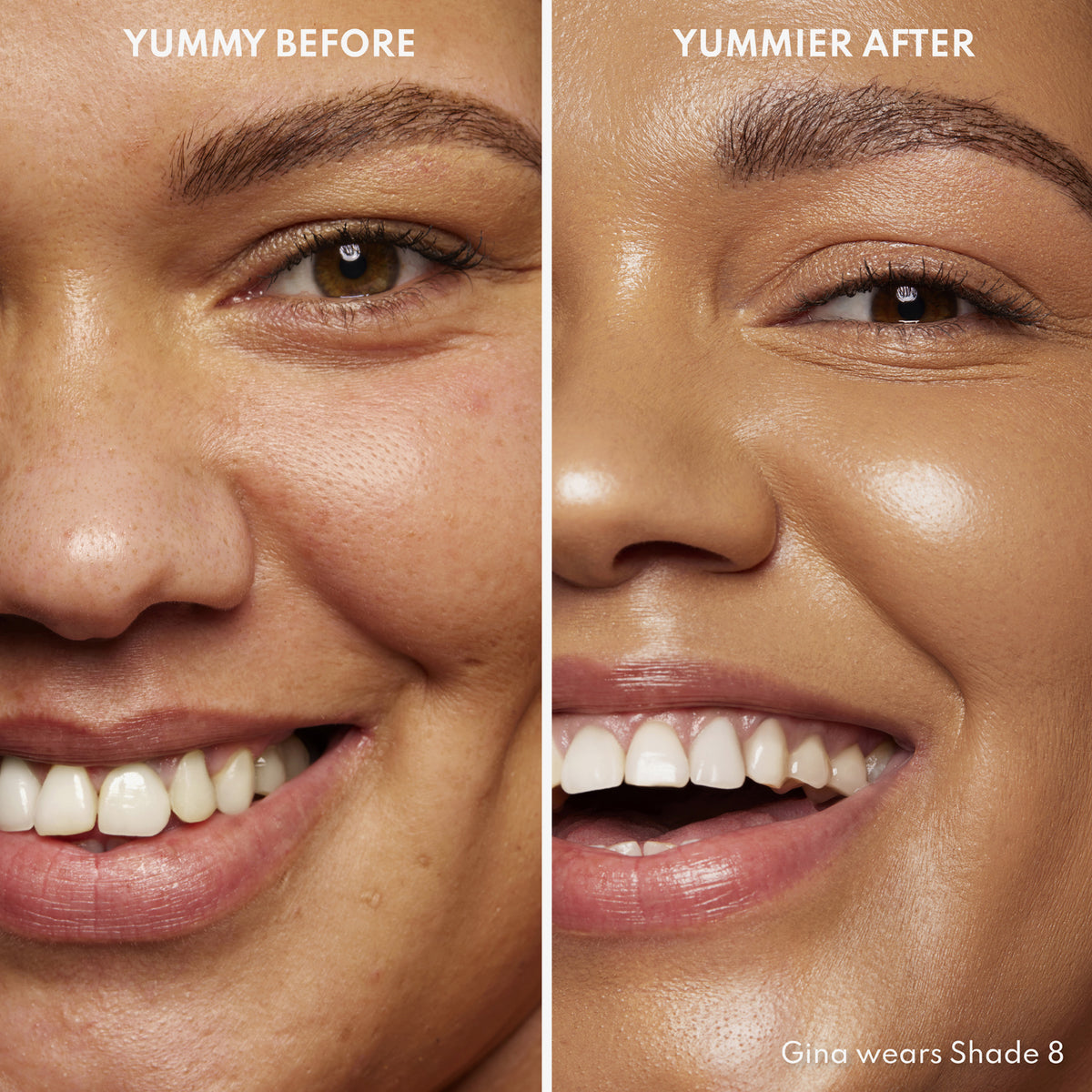 Vorher-Nachher-Bild einer Frau mit mittlerem Hautton nach Anwendung des Yummy Skin Serum Tint 8 – sichtbar ebenmäßiger Teint.