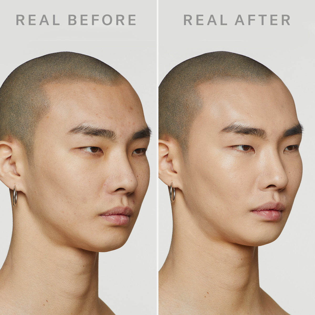 Nebeneinander stehende Porträts zeigen das Gesicht eines Mannes vor und nach der Anwendung von Dew Shield von Mesauda Beauty zur Hautglättung.