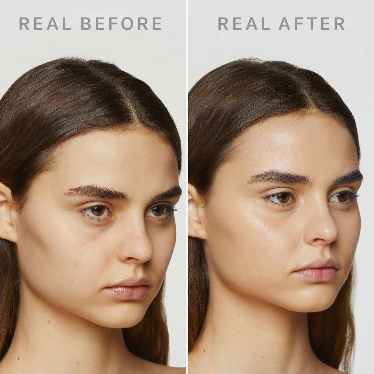 Die Gegenüberstellung des Gesichts einer Frau zeigt ihre Haut vor und nach der Anwendung von Mesauda Beauty's Dew Shield, wobei die Haut auf dem Nachher-Bild deutlich glatter ist.