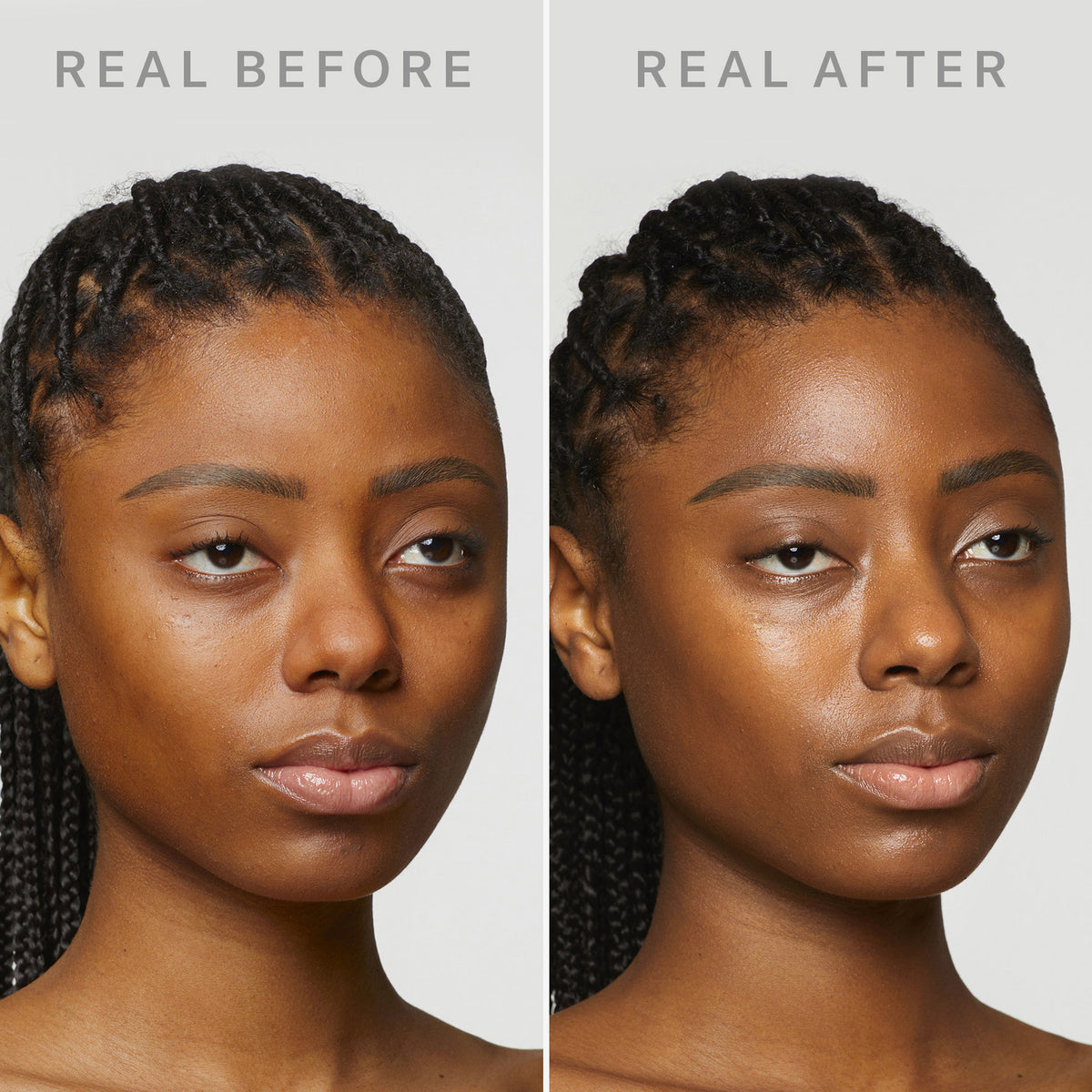 Das Gesicht einer Frau ist mit "Real Before" und "Real After" beschriftet und zeigt eine glattere, strahlendere Haut nach der Anwendung von Dew Shield von Mesauda Beauty.