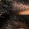 Ein Vorher-Nachher-Vergleich zeigt, dass „The Hair Serum“ von SWEED im Nachher-Bild für einen volleren, dichteren Haaransatz sorgt.