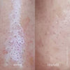 Vorher-Nachher-Bilder bei Anwendung von Zitproof Nose zeigen reduzierte Rötungen und eine glattere Hautstruktur.