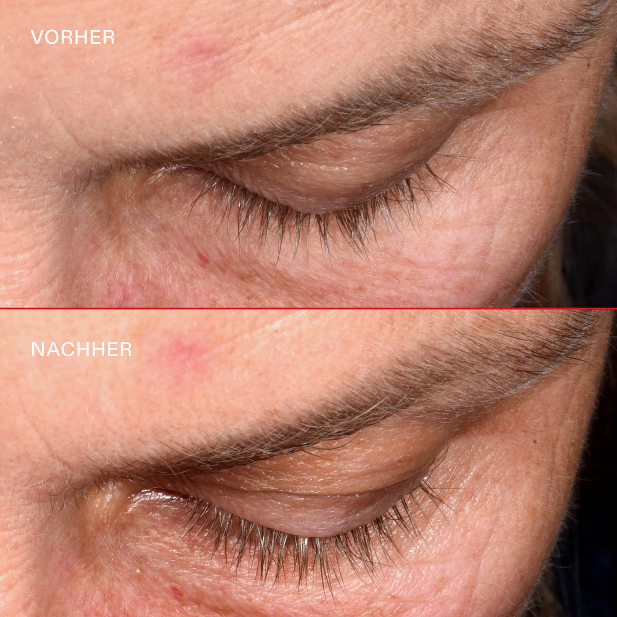 Die kurzen Wimpern einer Frau vor (oben) und die längeren definierteren Wimpern (unten) nach Anwendung des Original OLAPLEX® Lashbond Building Serum.