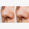 Nebeneinanderliegende Nahaufnahme einer Nase vor und nach der Verwendung des Cleansing Oils. Das Nachher-Bild zeigt eine sichtbar reinere Haut.