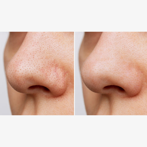 Heartleaf Pore Control Cleansing Oil