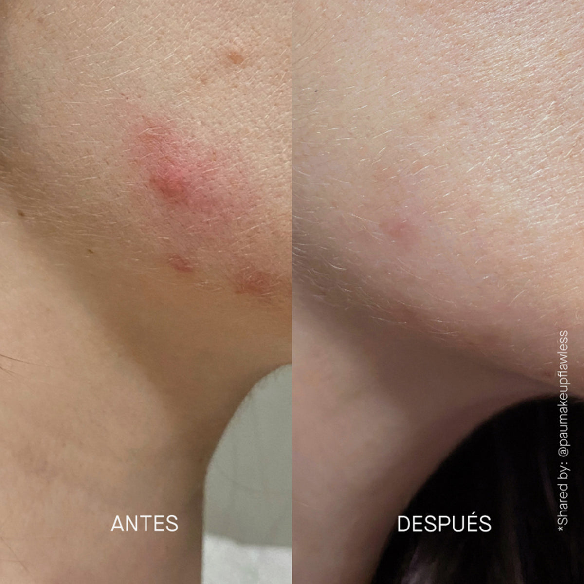 Vorher/ Nachherbild bei Anwendung von Postzit