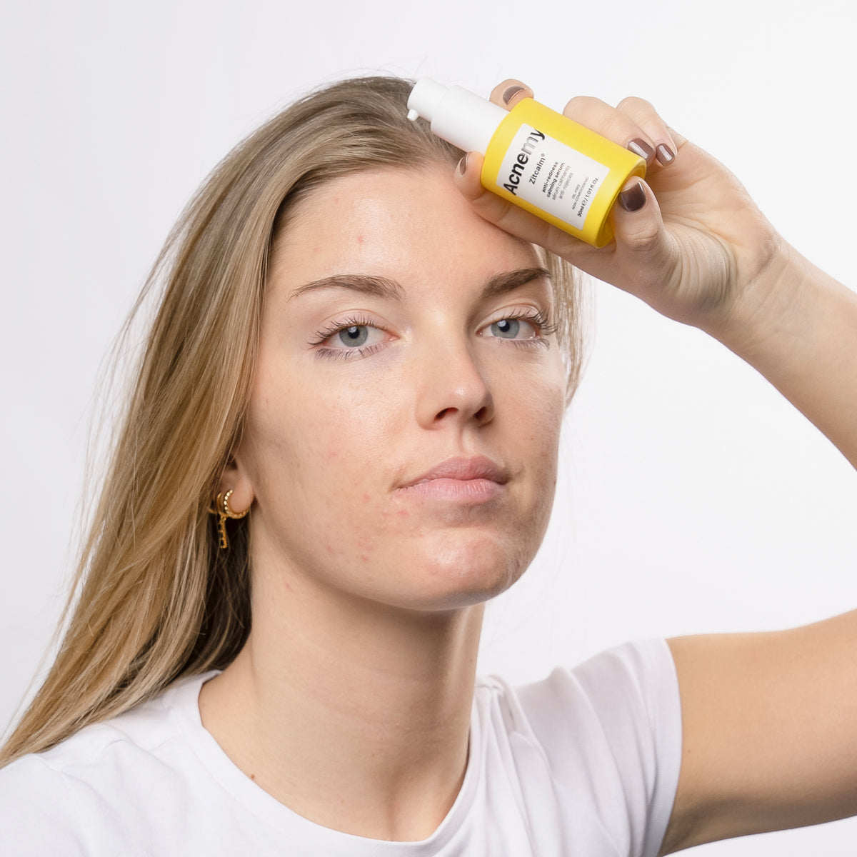Eine Person hält mit neutralem Gesichtsausdruck eine Flasche Zitcalm Serum an ihre Stirn.