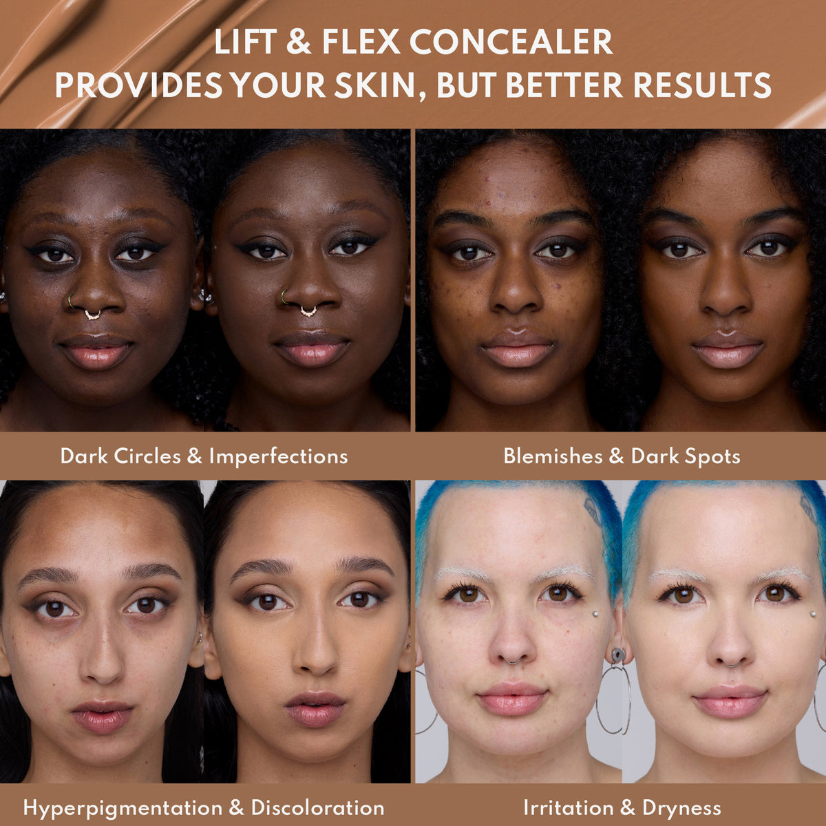 Vorher-Nachher-Bild von vier Personen, das zeigt, wie der Lift & Flex Concealer Hautunreinheiten und Hautprobleme abdeckt.