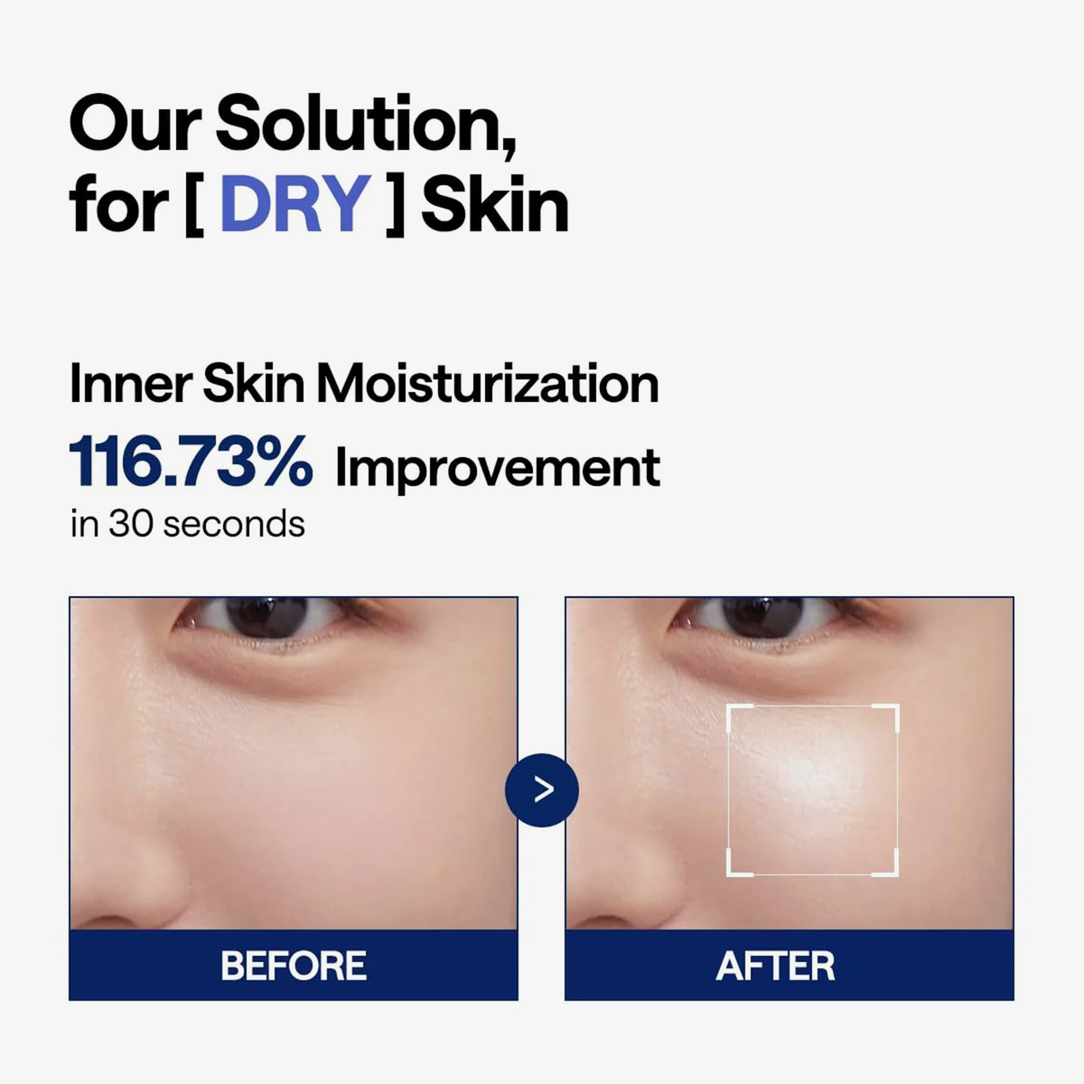 Vorher- und Nachher-Nahaufnahmen zeigen eine besser durchfeuchtete, strahlendere Haut nach der Anwendung des Mediheal Watermide Moisture Pad für trockene Haut.