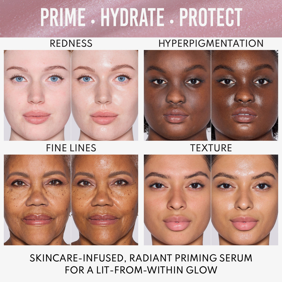 Vier Vorher-Nachher-Bilder von Frauen mit unterschiedlichen Hauttönen zeigen, dass das Yummy Skin Glow Serum Rötungen, Hyperpigmentierung und feine Linien reduziert und die Textur verbessert.