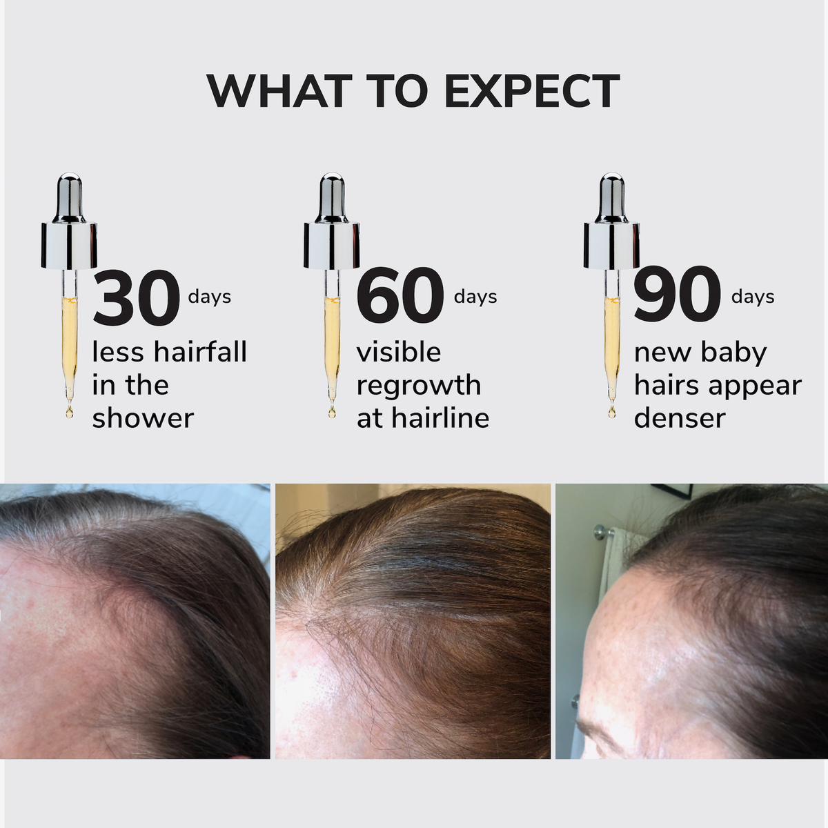 Infografik, die den Fortschritt des Haarwachstums nach 30, 60 und 90 Tagen mit Fotos zur Verbesserung bei Anwenudng des Youth Juice Collagen Scalp Treatment.