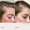 Nebeneinandergestellte Bilder der Kopfhaut einer Frau am Tag 0 und am Tag 90 zeigen eine sichtbare Verbesserung des Haarwachstums mit Living Proof Scalp Care Density Serum.