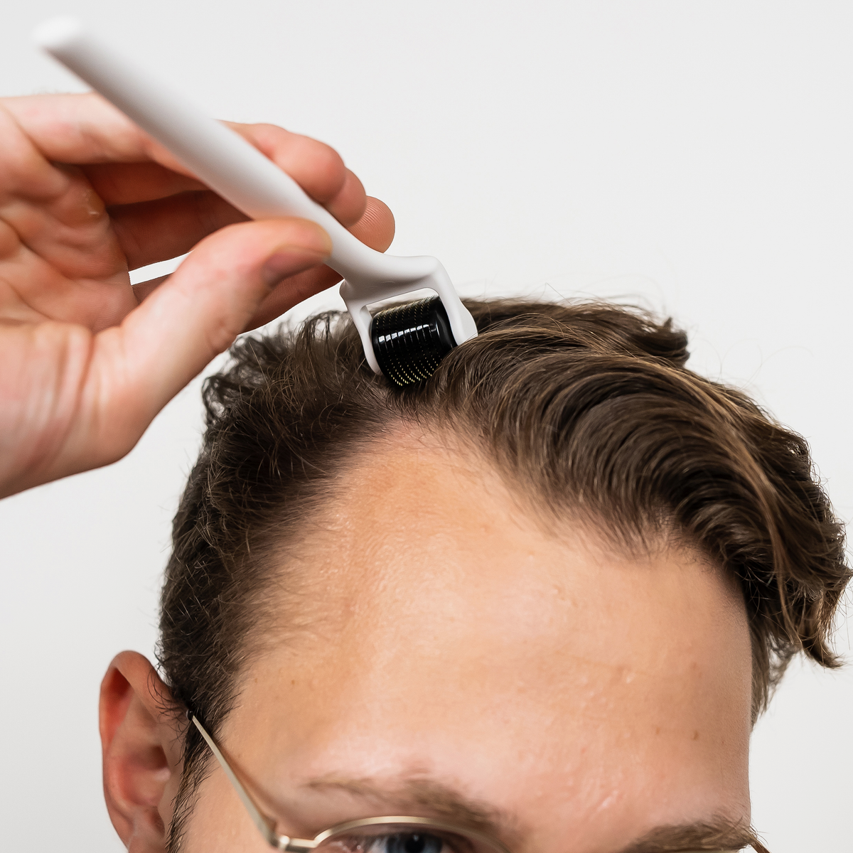Eine Person verwendet den Scandinavian Biolabs Scalp Activation Derma Roller auf ihrer Kopfhaut und konzentriert sich dabei auf den Haaransatz in der Nähe der Stirn.