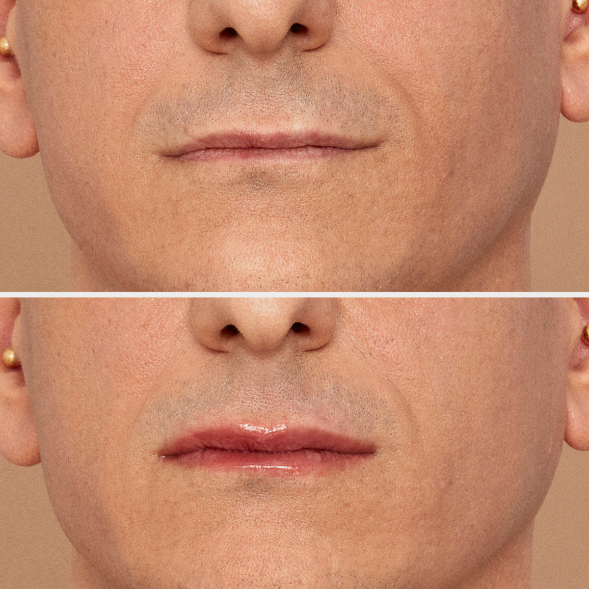 Eine Nahaufnahme zeigt oben die Lippen ohne prdukt drauf und unten die glänzenden Lippen nach dem Auftragen von Lip Plumper – Viper.