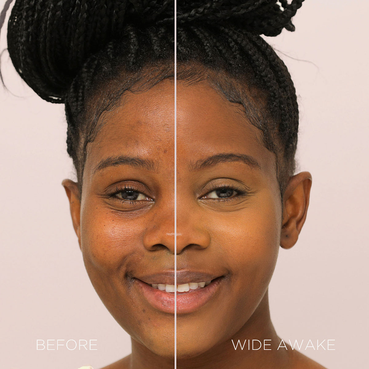 Gesicht einer Frau vor und nach der Verwendung des Wide Awake Full Coverage Concealers Honey Roast; nachher ebenmäßig leuchtender Teint.