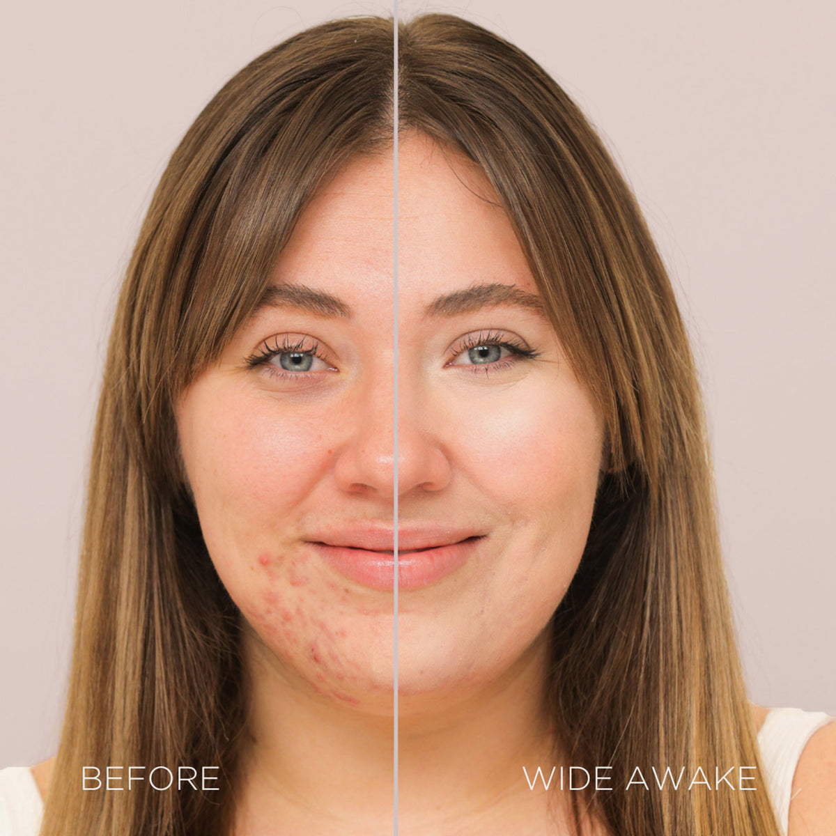 Gesicht einer Frau vor und nach der Verwendung des Wide Awake Full Coverage Concealers Almond Milk; nachher ebenmäßig Teint.