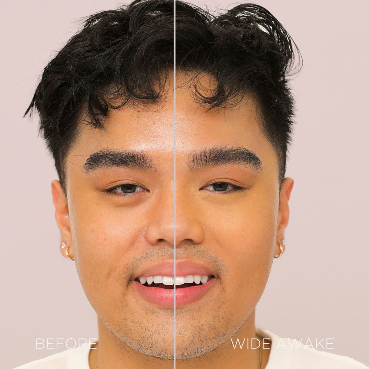 Gesicht einer Frau vor und nach der Verwendung des Wide Awake Full Coverage Concealers Chai Latte; nachher ebenmäßig Teint.